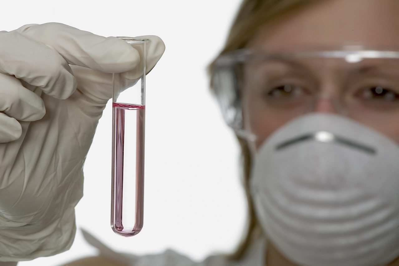 Le prospettive della ricerca nella terapia del diabete di tipo 1