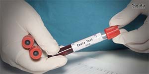 Ebola, l’Oms: cresce l’epidemia in Congo, 57 casi e 35 morti