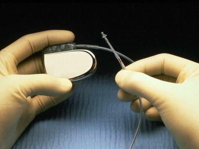 Lazio, accordo Quadro Consip: 45mila pacemaker e relativi elettrocateteri