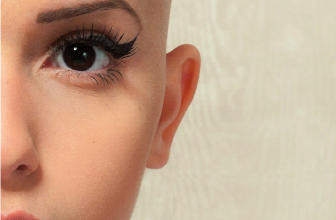 La terapia della felicità: ‘Ri-scatti’ dei giovani dell’Istituto Tumori. Andrea Ferrari: «Spezzare le catene» | FOTO