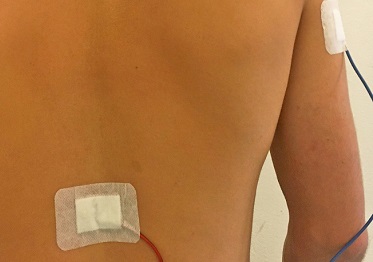 Recuperare il linguaggio attraverso il midollo spinale: lo studio su Frontiers of Neurology