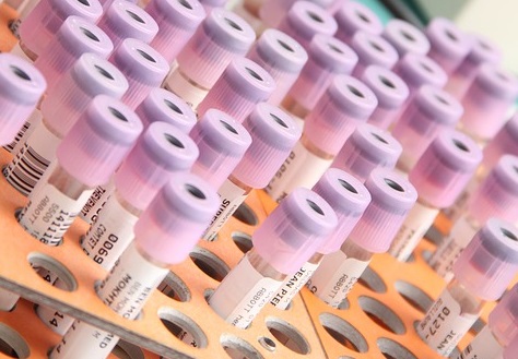 Deficit di Alfa 1 antitripsina, possibile causa di malattie respiratorie ed epatiche: attenzione a diagnosi