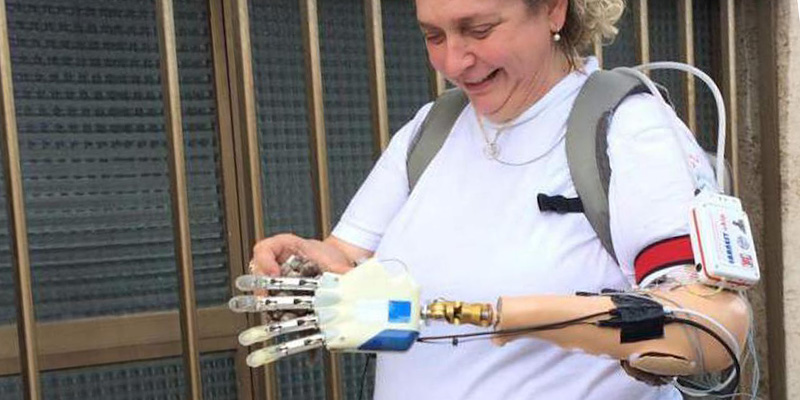 Sperimentata al Gemelli di Roma mano bionica che restituisce il tatto