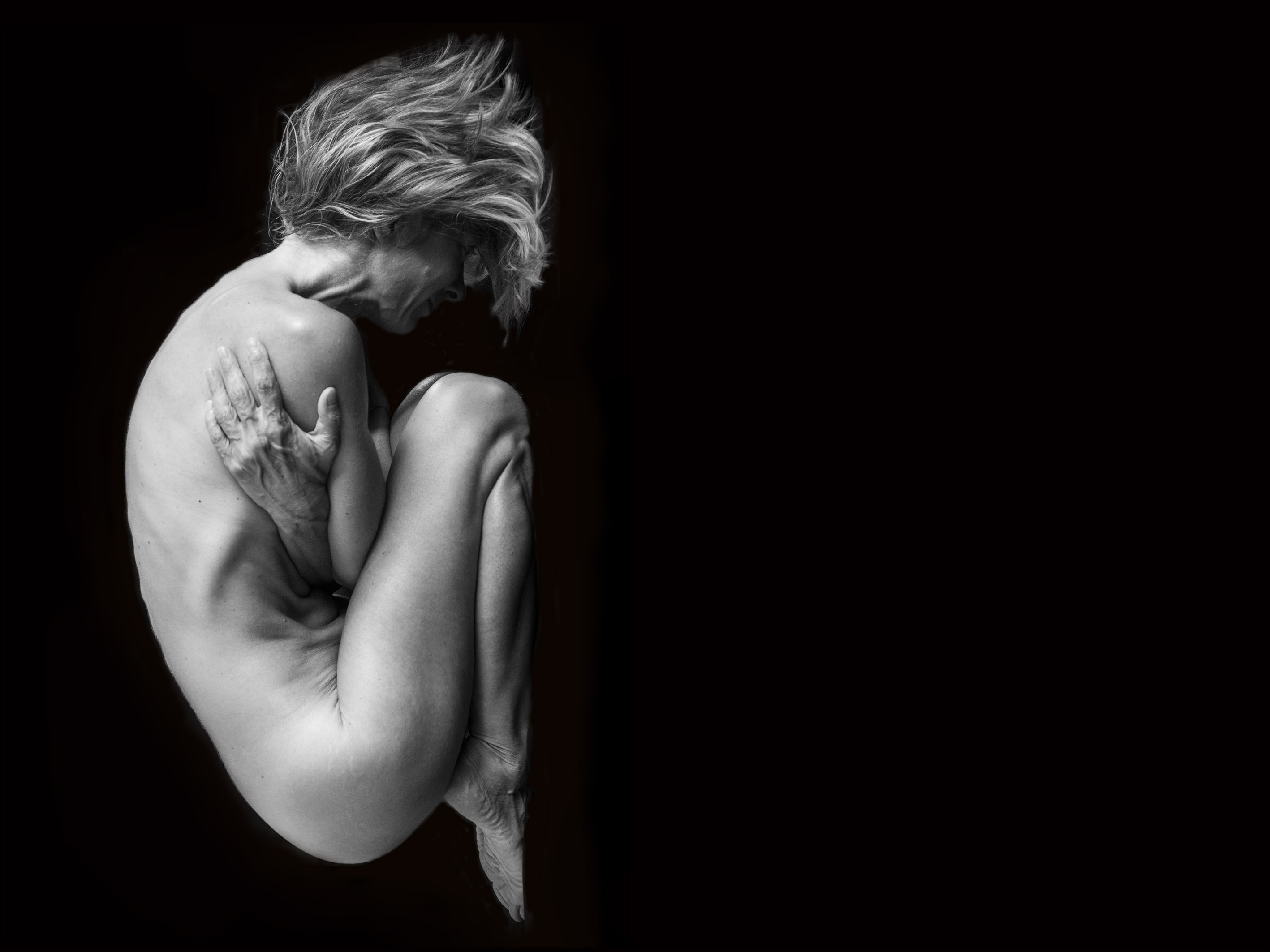 Milano, il Parkinson giovanile in mostra all’IRCCS Galeazzi: le immagini raccontano la malattia