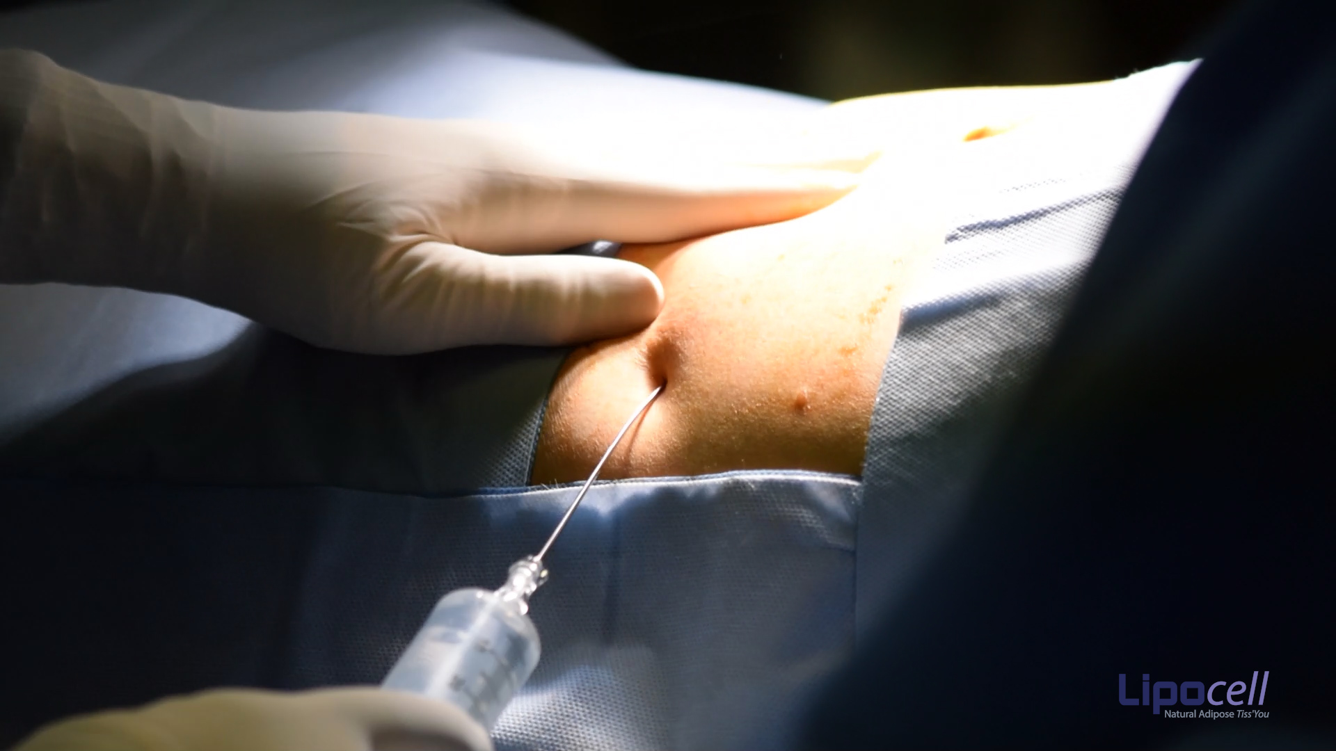 Chirurgia plastica ed estetica, D’Andrea (Sicpre): «Nuova frontiera Medicina Rigenerativa»