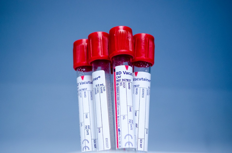 HIV, Iss: “Diagnosi in aumento, troppe sono tardive”