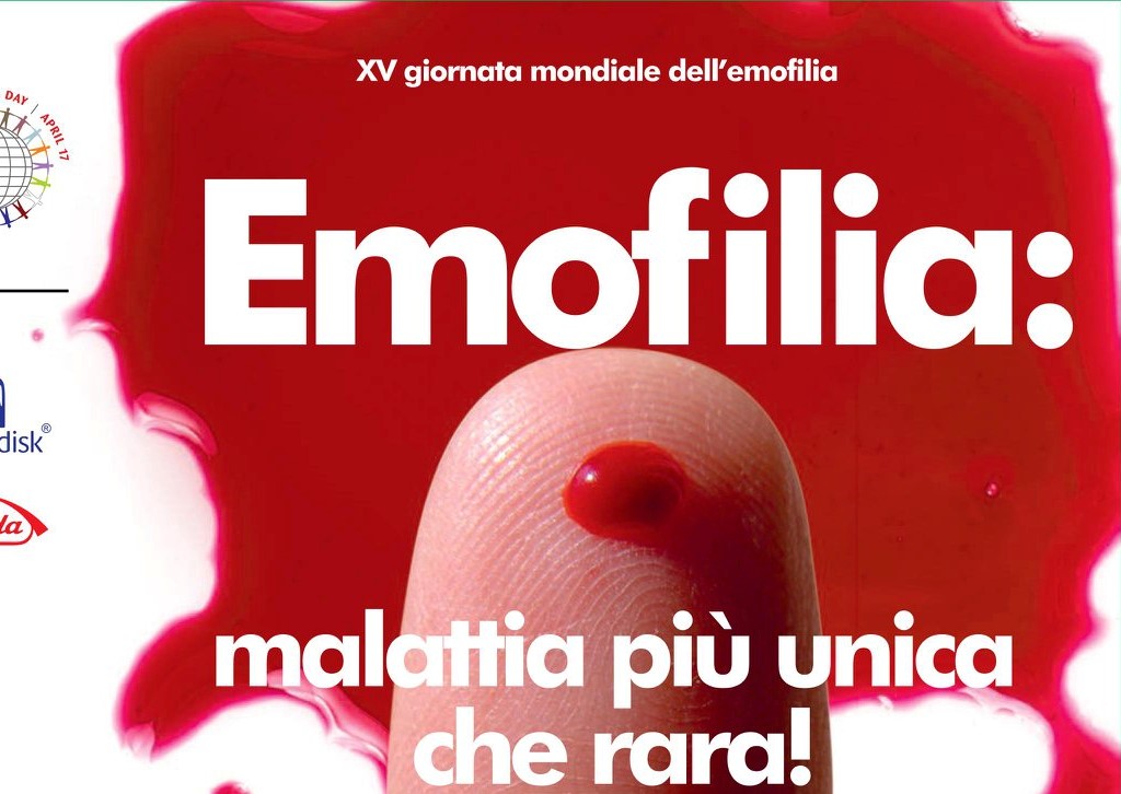 Giornata Mondiale Emofilia, manca attuazione accordo Mec. L’appello alle Regioni: «Garantite la qualità dei servizi»