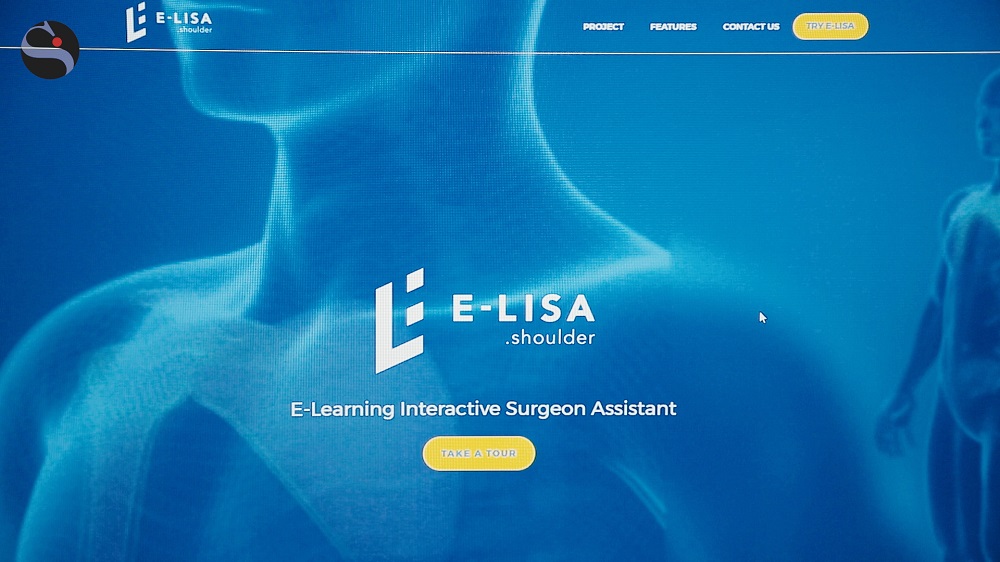 Ortopedia, la rivoluzione di E-Lisa, l’algoritmo che anticipa l’esito degli interventi