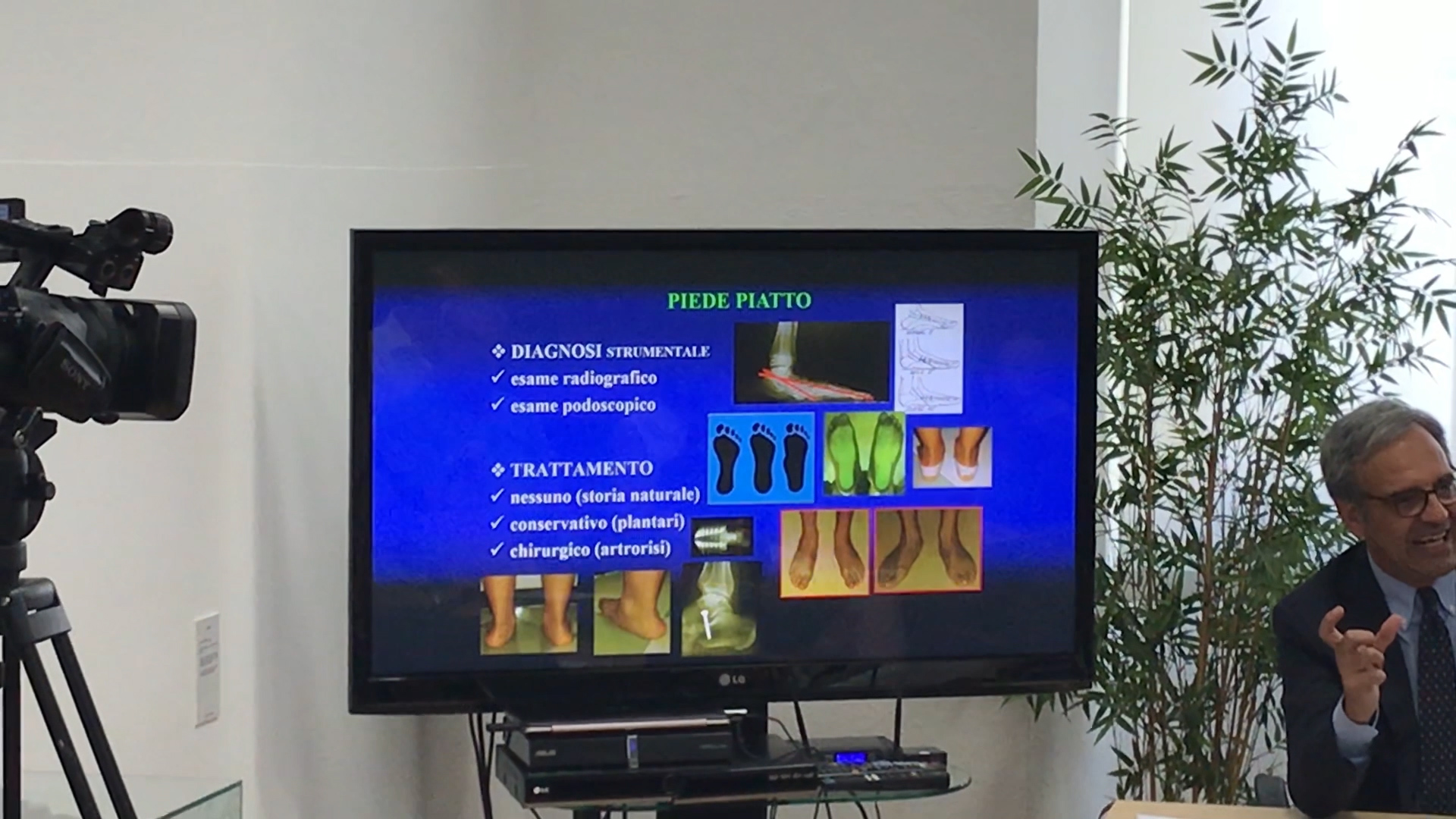 Ortopedia pediatrica, dalla scoliosi al piede piatto: ecco quando una diagnosi precoce può fare la differenza