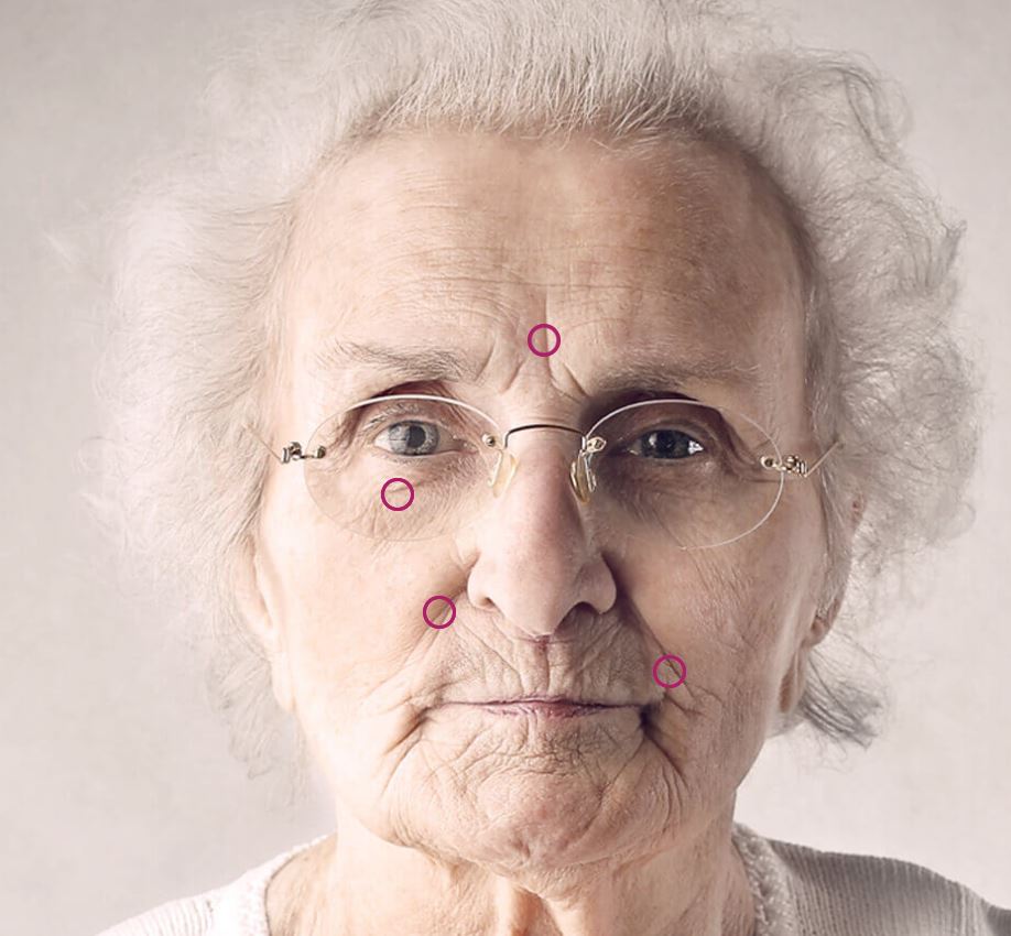 A Milano seconda tappa dello screening gratuito della fibrillazione atriale con la mostra audio-visiva “Più la vita ti segna, più valore ha”