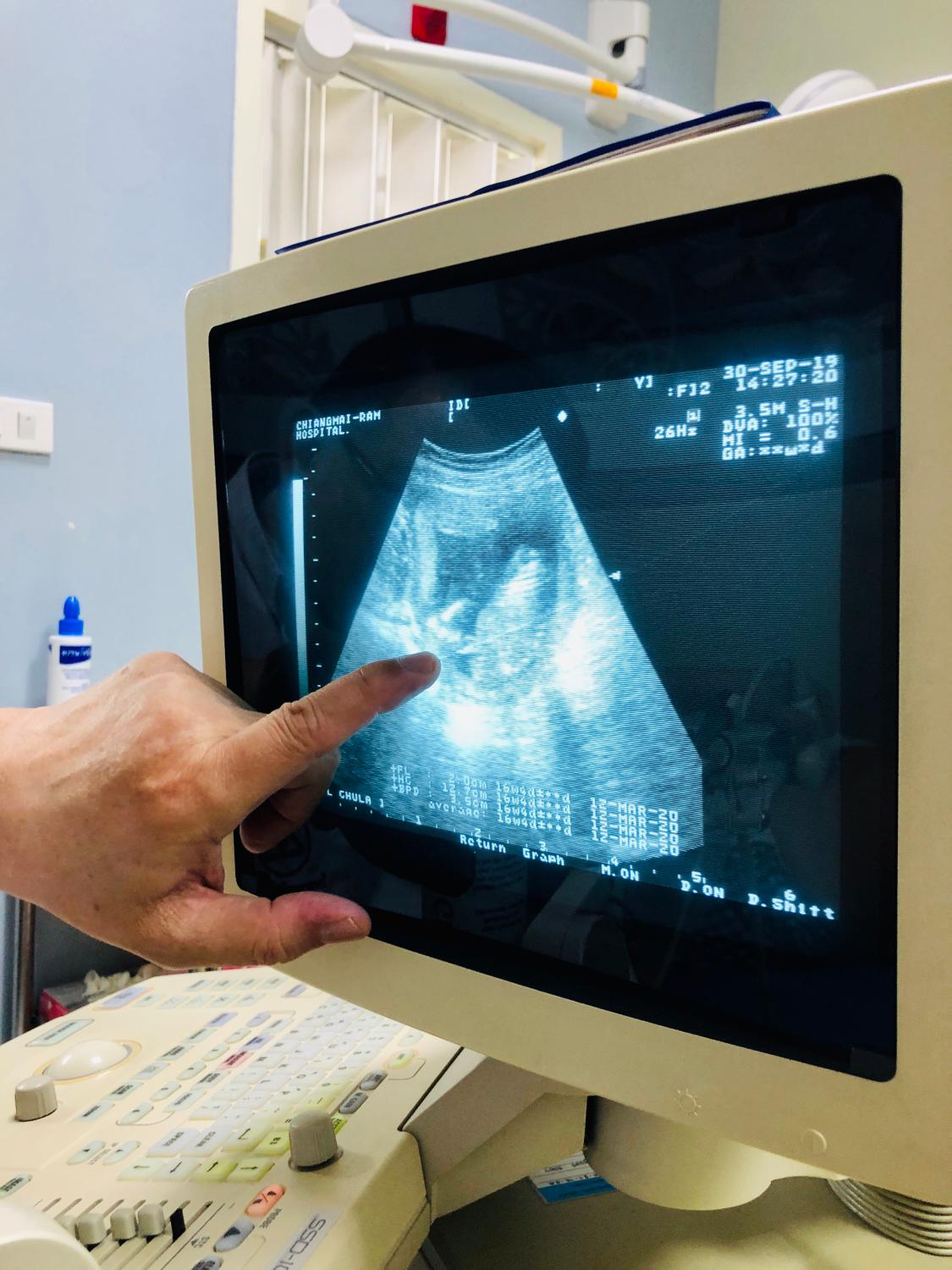 Malattie rare, il 96,5% dei neonati ha avuto lo screening metabolico: nel 2012 erano il 25%