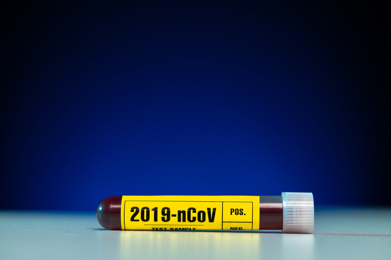 Test sierologici privati in Lombardia, migliaia di prenotazioni e prime positività