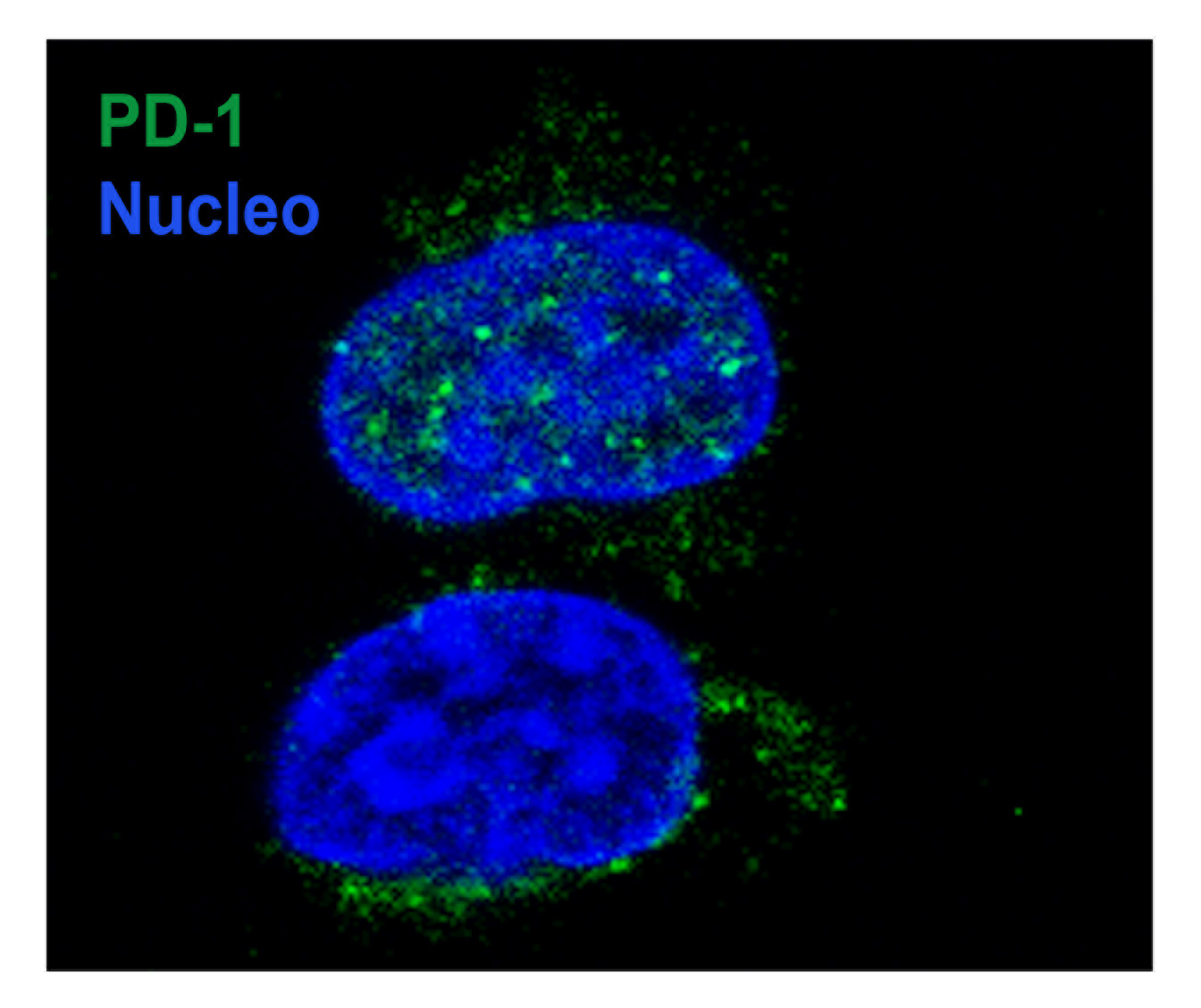 Lotta ai tumori: scoperto meccanismo molecolare con cui ingannano le cellule “natural killer”