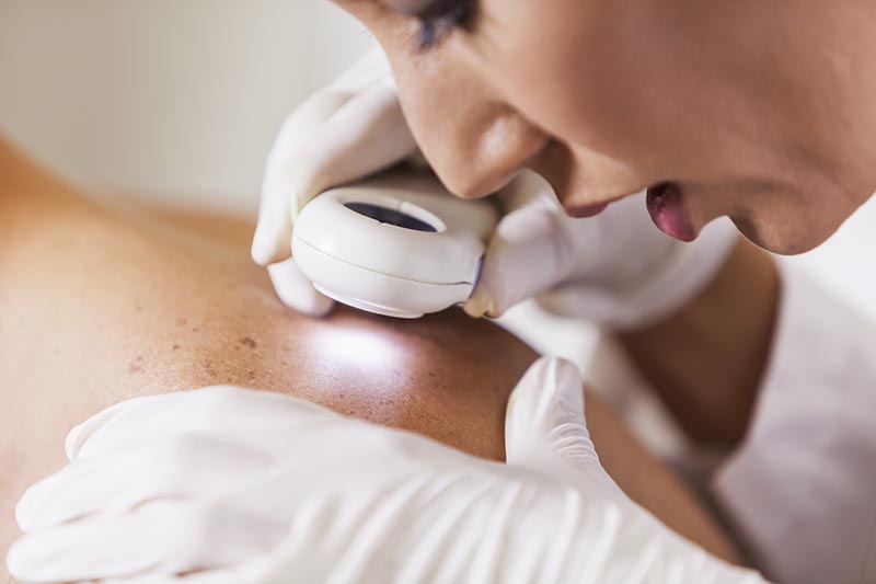 DM 70, levata di scudi dei dermatologi SIDeMaST: «Pazienti rischiano di perdere assistenza»