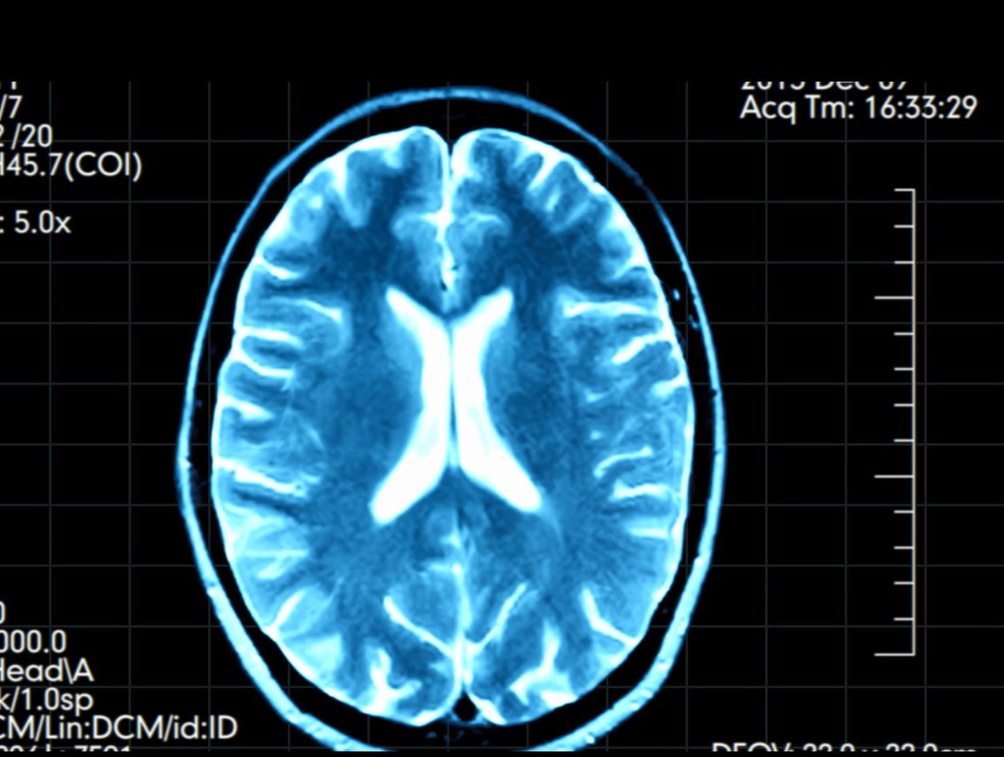 Quali meccanismi ci fanno sentire responsabili delle nostre azioni? La risposta in uno studio italiano