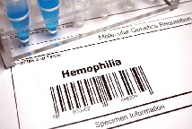 Emofilia, Schmitt (CSL Behring): «Necessario approccio olistico per poter essere partner del SSN»