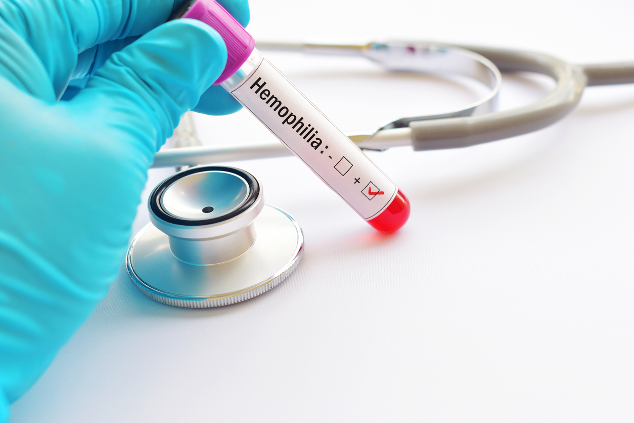 Emofilia, presentato il Rapporto di Omar nell’ottica del ‘Value Based Health Care’