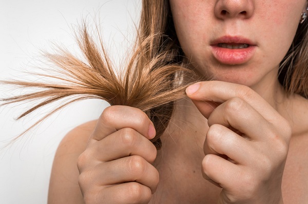 Perdita di capelli a ciocche? L'alopecia può essere colpa del Covid