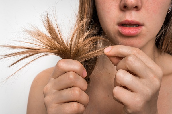 perdita di capelli a ciocche