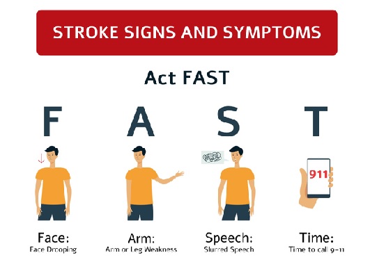 Ictus: sintomi, fattori di rischio e prevenzione