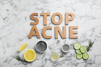 Rimedi naturali contro l'acne Rimedi naturali contro l'acne