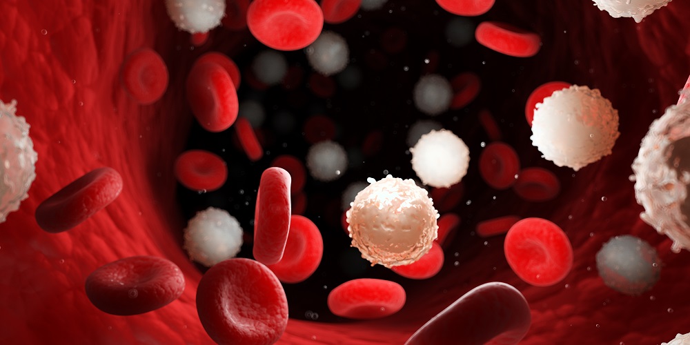 Tumori del sangue, in 20 anni guarigioni quasi raddoppiate. Amadori (AIL): «Così la ricerca ha rivoluzionato lo scenario»