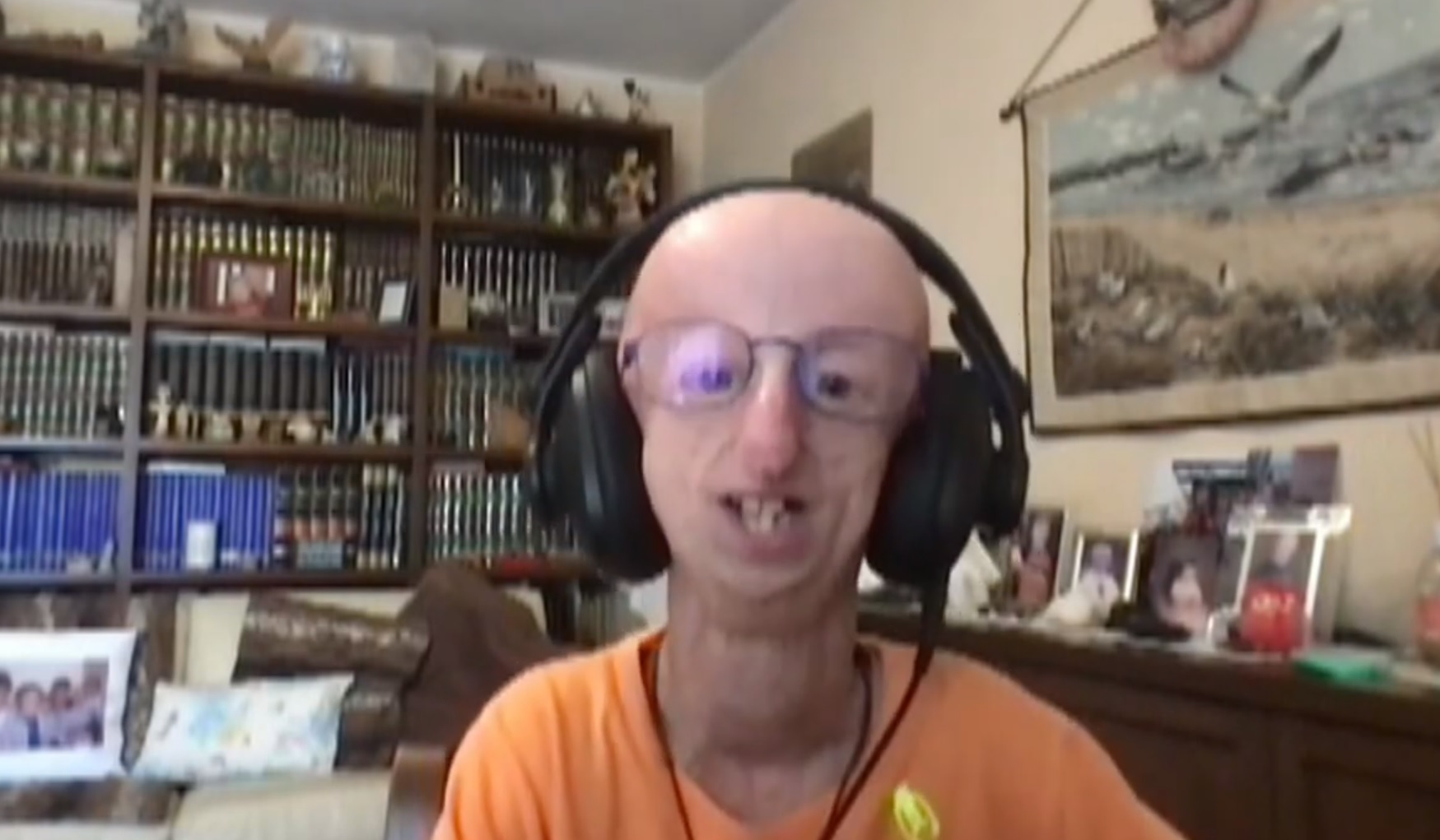 Sammy Basso, l’addio al più longevo malato di progeria