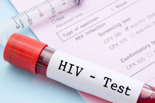 La diagnosi: il test dell'Hiv La diagnosi: il test dell'Hiv