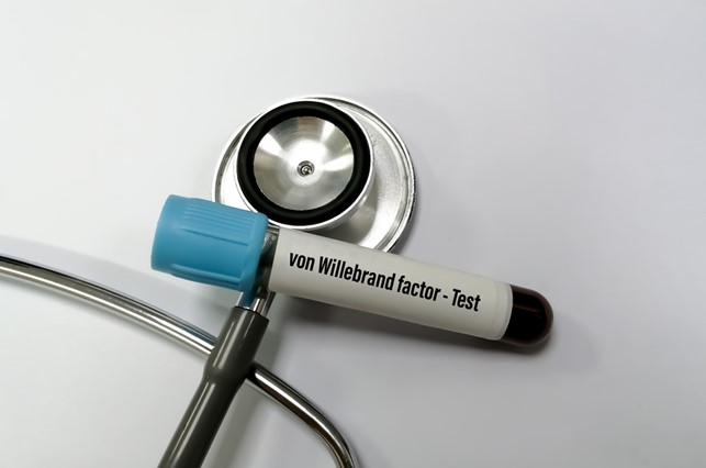 aPTT, il test ADAMTS13 va inserito nei LEA. Troppi i costi per i pazienti emersi dall’indagine IQVIA