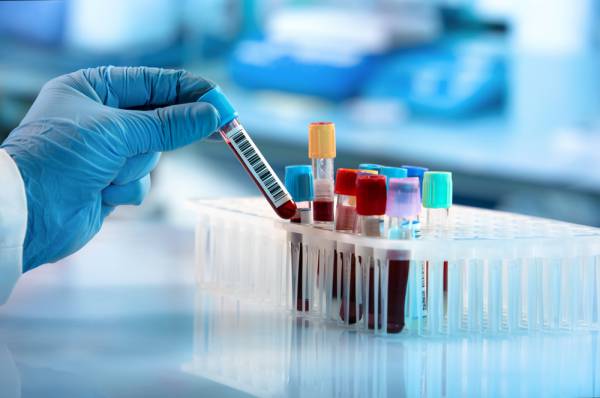 Biopsia liquida: la nuova strategia per battere il cancro sul tempo