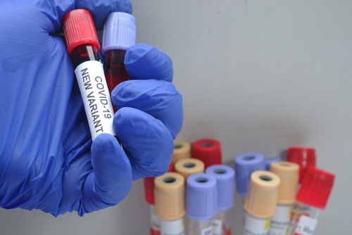 Covid, Oms: nuove varianti meno gravi e livelli di immunità più elevati