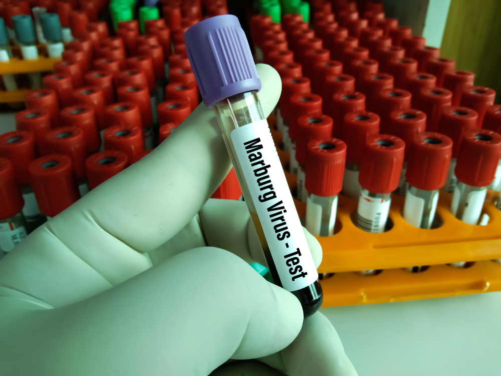 Virus Marburg, Oms: “Il focolaio in Tanzania è confermato. Presto tre milioni di dollari per gestire l’emergenza”