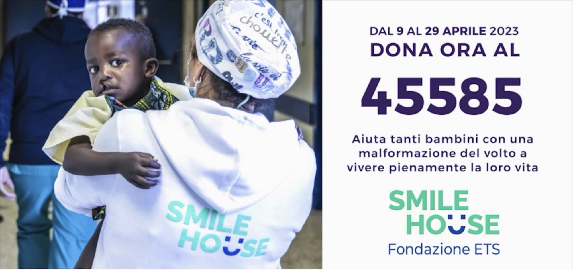 Il valore di un sorriso: Sofia nata con una malformazione al volto e salvata da Fondazione Smile House