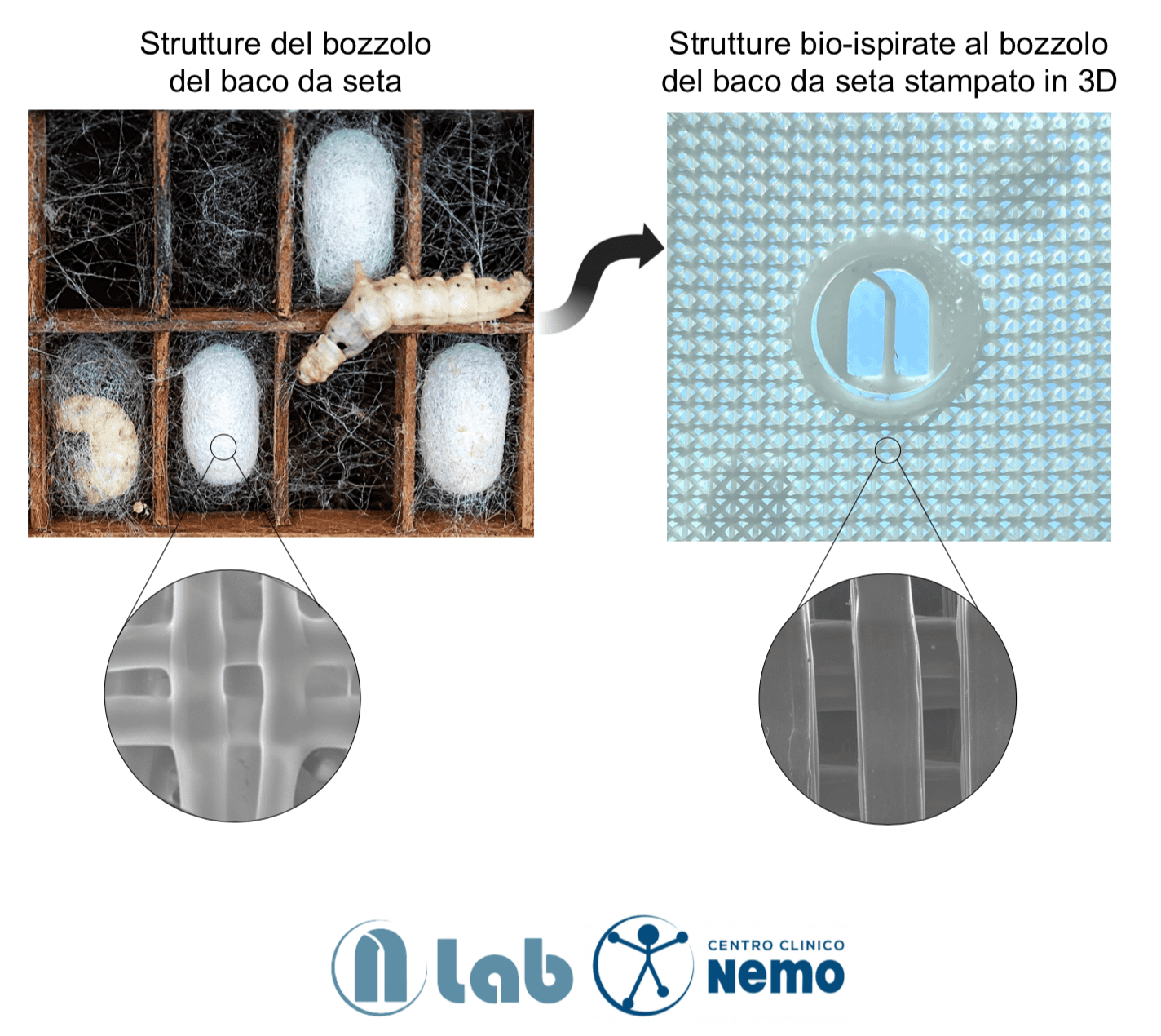 Malattie neuromuscolari: dal baco da seta la nuova ortesi che supporta l’indebolimento muscolare
