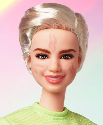 La Fondazione Consulcesi vince l’asta per “Barbie Bebe”: i proventi all’Art4Sport della campionessa paralimpica