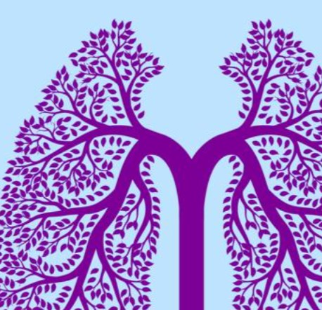 Carcinoma polmonare a piccole cellule in stadio esteso: dallo studio IMforte un passo avanti nel trattamento