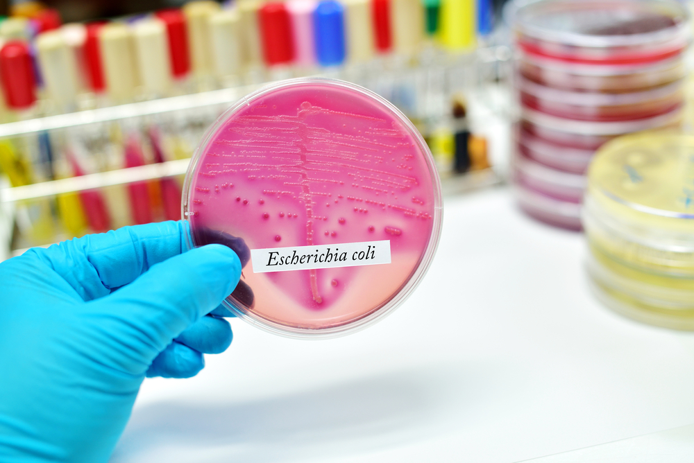 Tumore del colon, un enzima del batterio Escherichia coli diventa “osservato speciale”