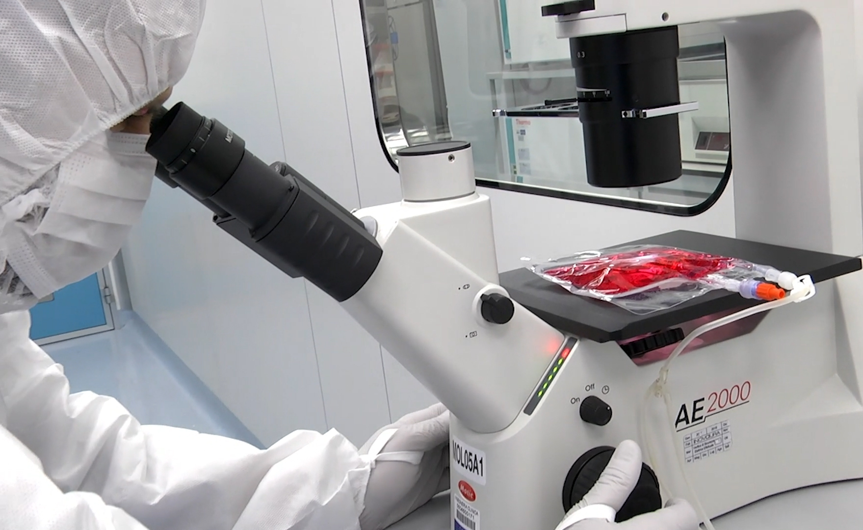 Al Bambino Gesù terapia CAR-T sui primi 3 pazienti con malattie autoimmuni