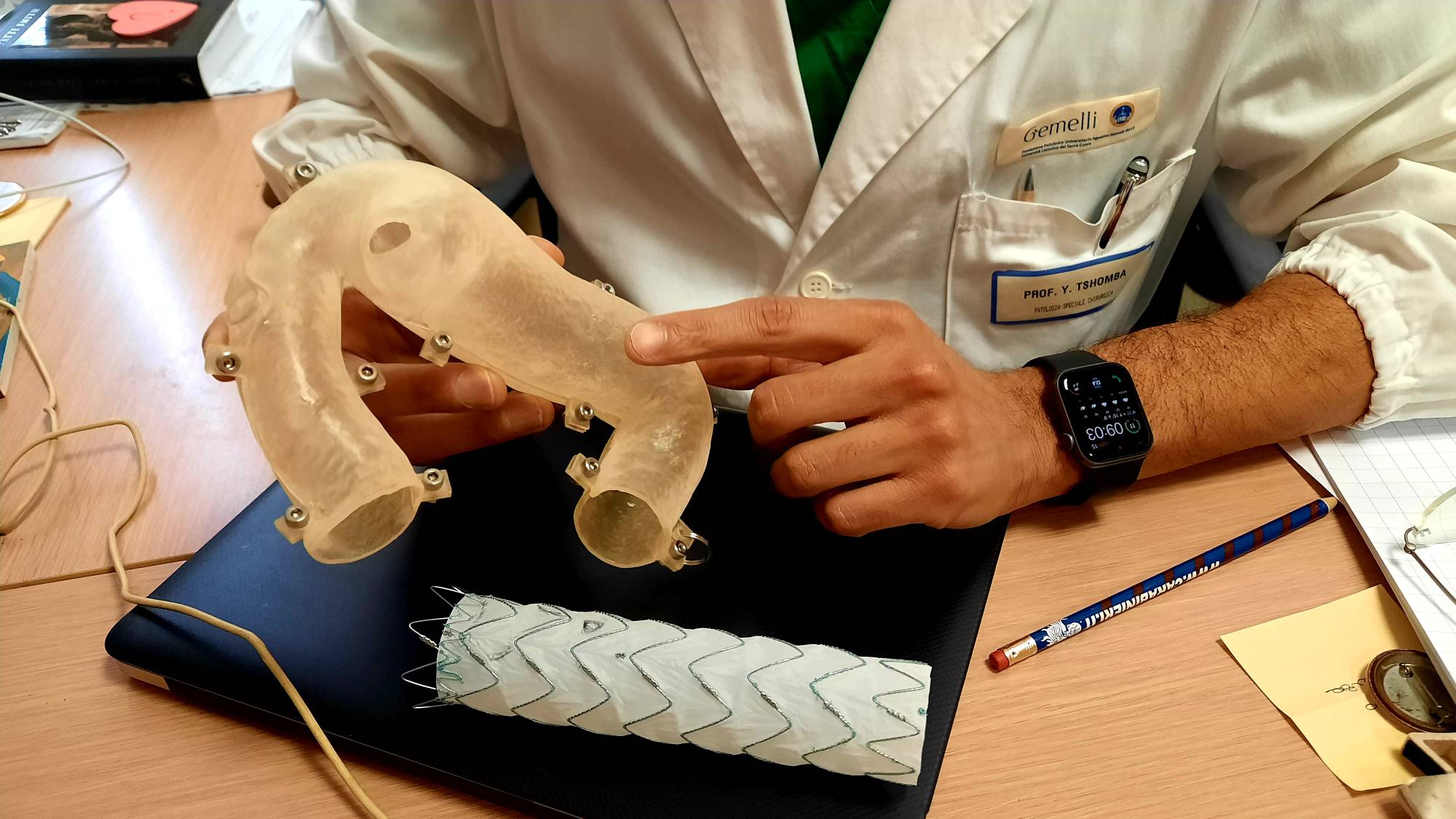 Chirurgia vascolare ‘di precisione’, ecco la protesi aortica ‘ritagliata’ su misura per il paziente