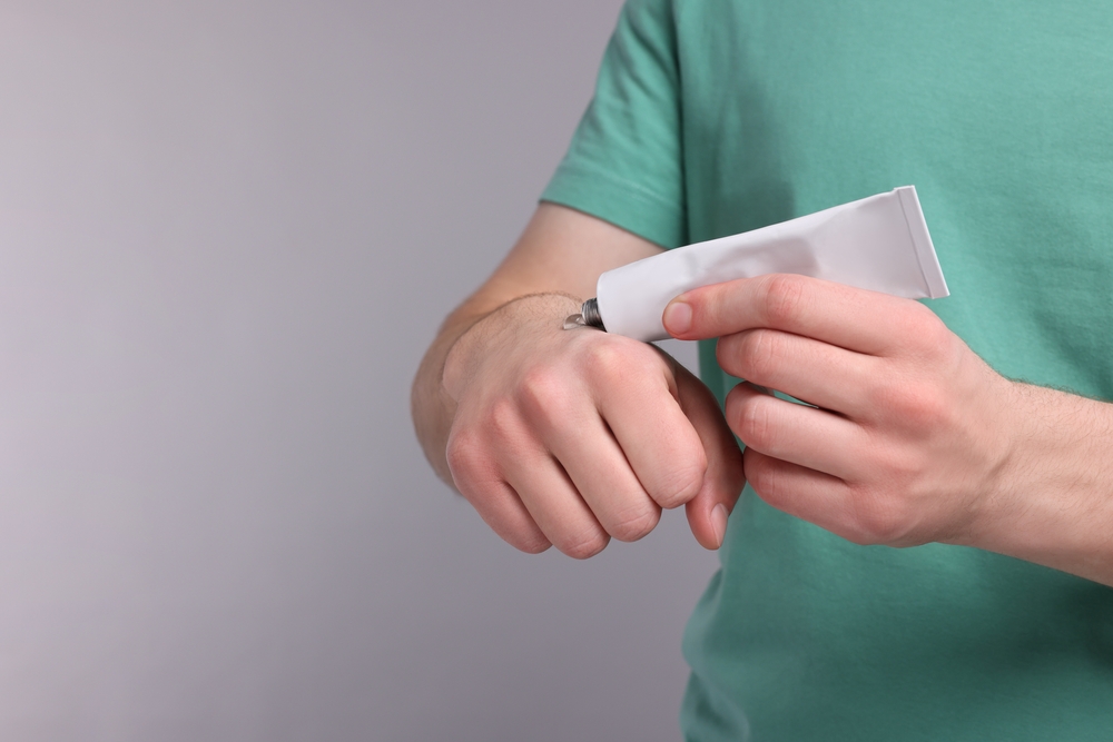 Eczema: creme al cortisone causano astinenza, studio ne rivela i sintomi