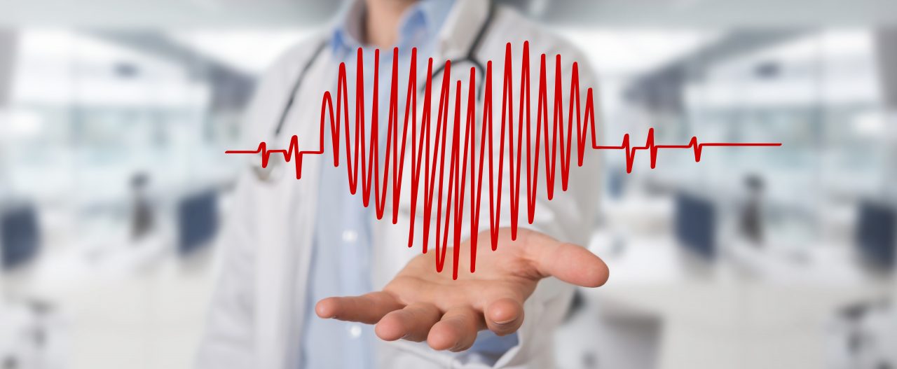 Ictus e infarti, giovani donne più a rischio degli uomini se affette da diabete e pre-diabete