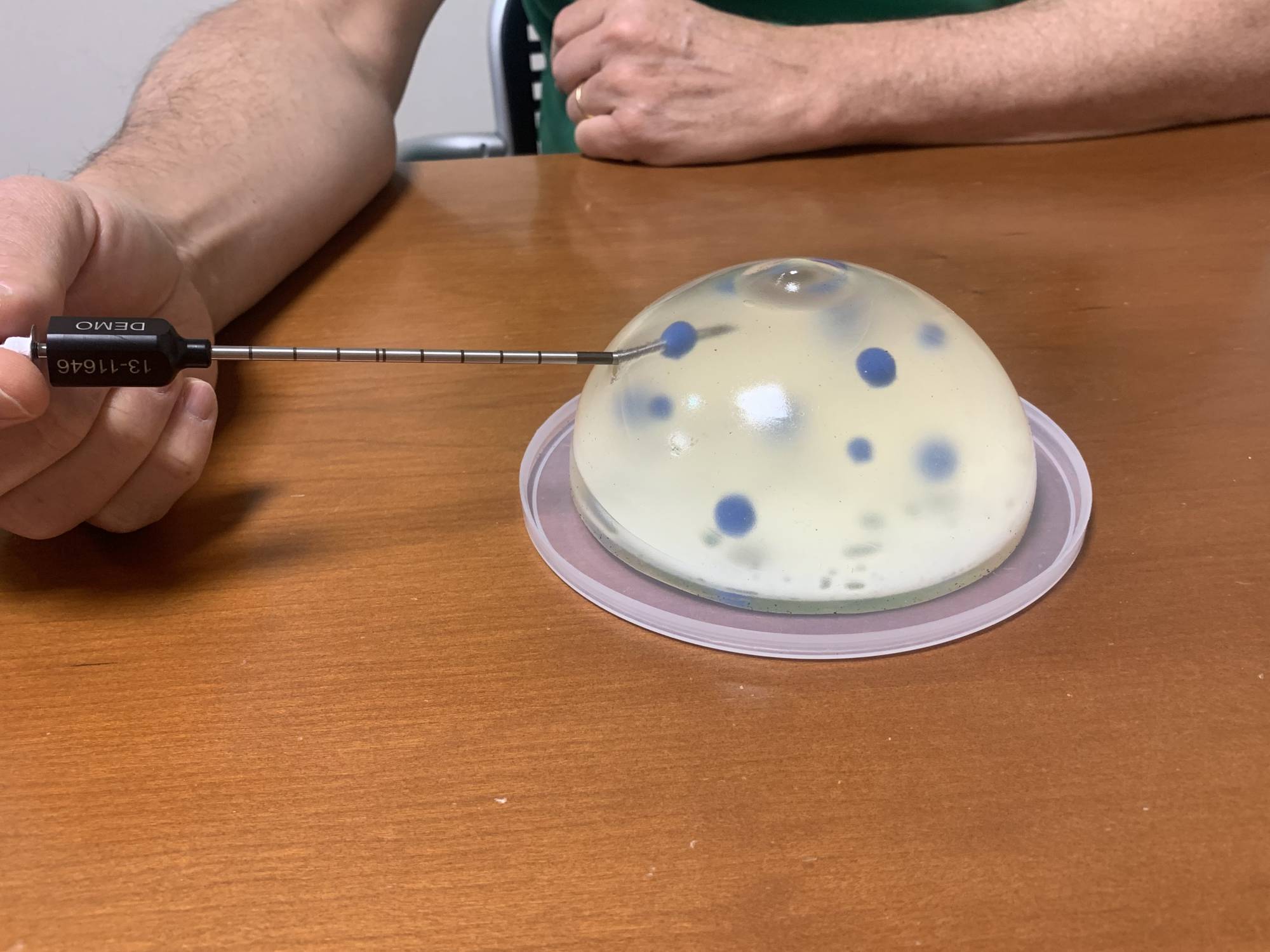 Tumore al seno, all’IEO via a studio su crioablazione per rimuovere il cancro senza bisturi