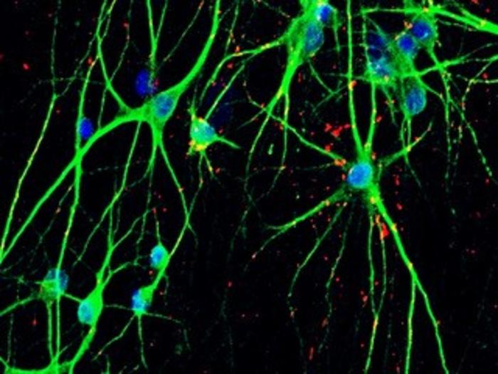 Nasce l’archivio delle cellule dei disturbi psichiatrici