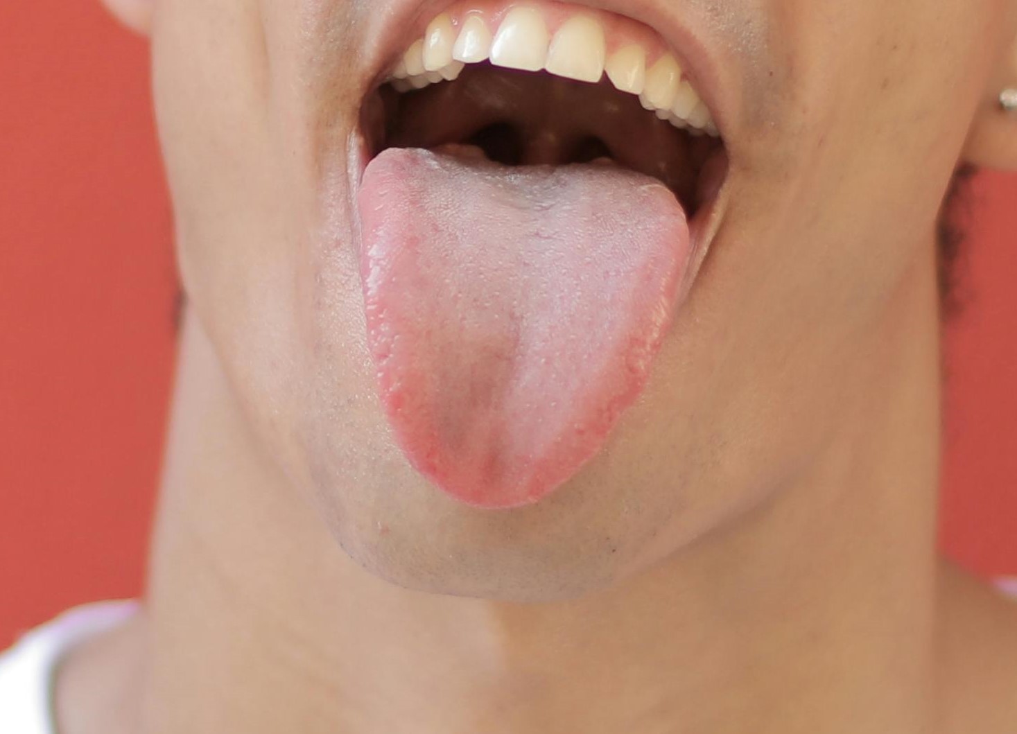 Intelligenza artificiale, con una foto della lingua valuta il rischio coronarico