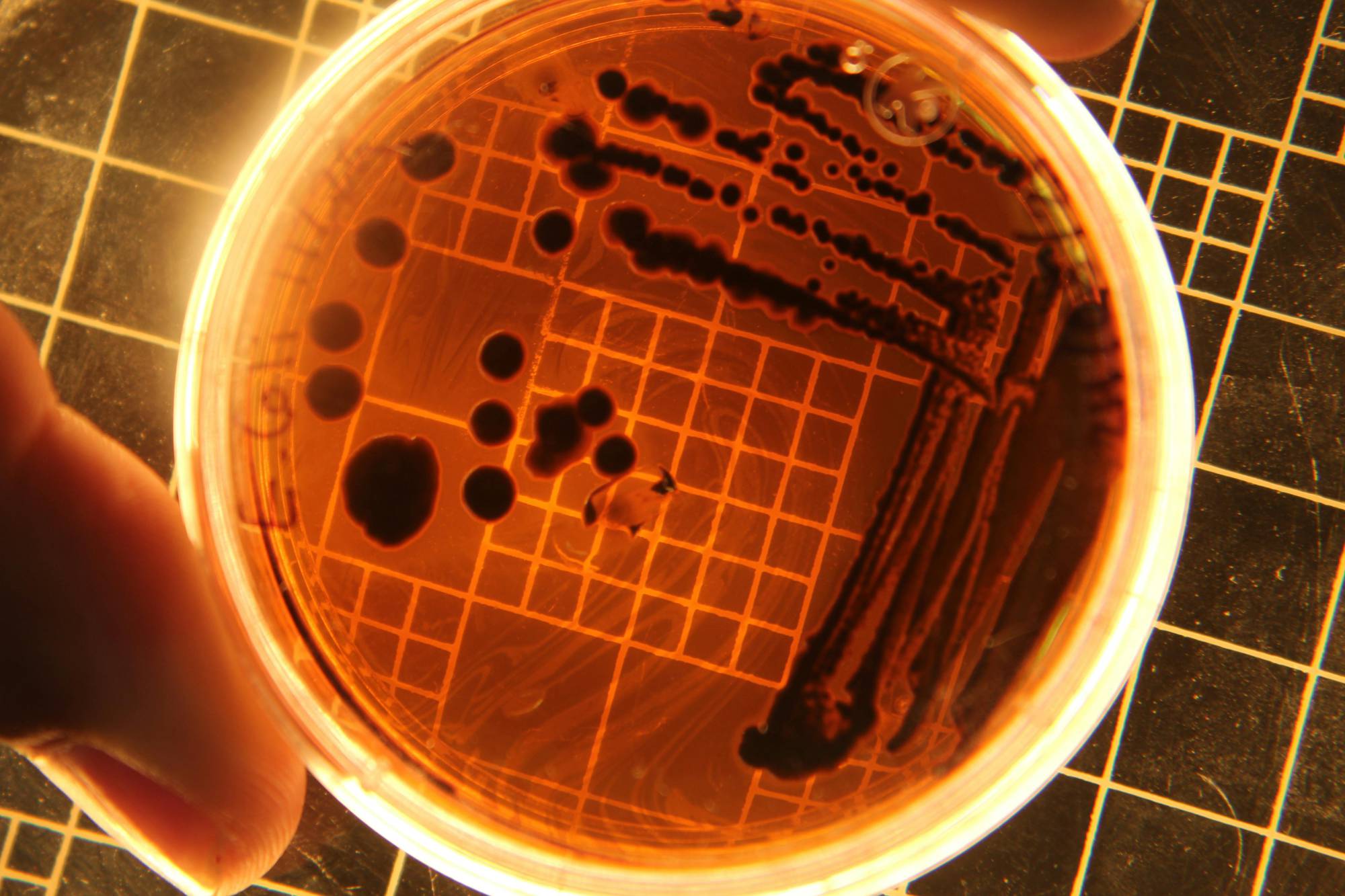 Zoonosi: “Salmonella sul podio, casi di listeriosi in aumento, West Nile in calo”