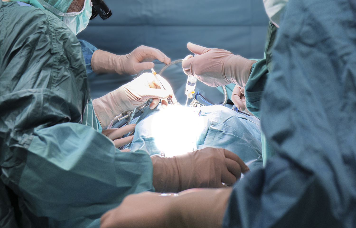 Cancro del rene, al Bambino Gesù rimosso un tumore che aveva ‘invaso’ il cuore