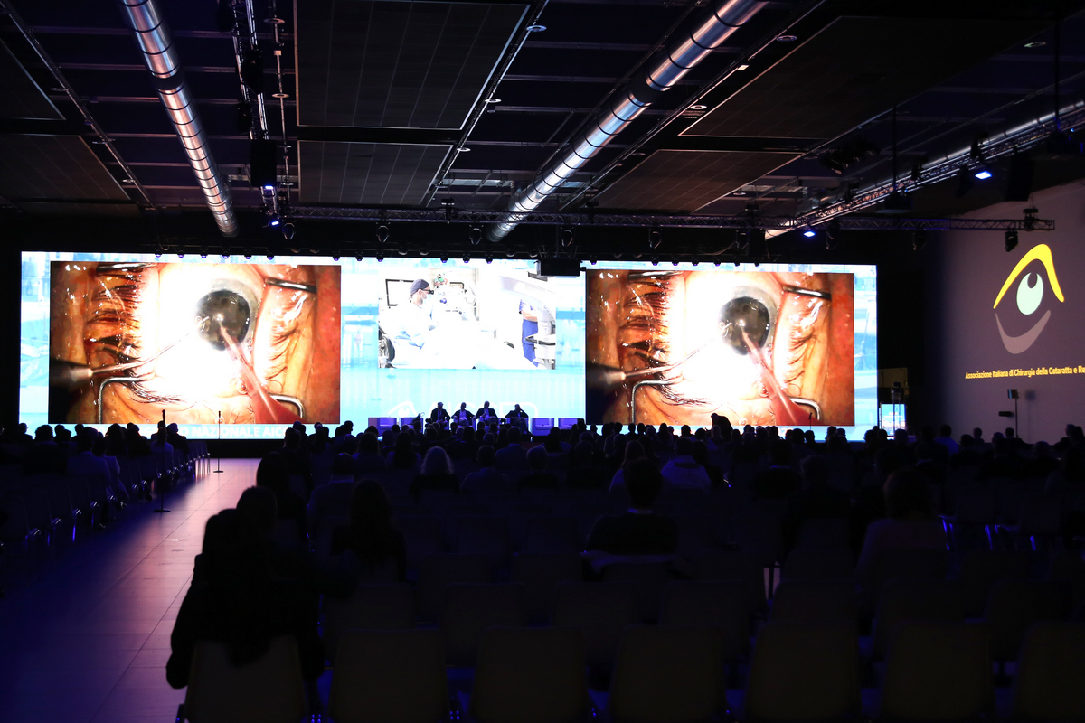 Cataratta, con l’intelligenza artificiale la chirurgia è sempre più efficace