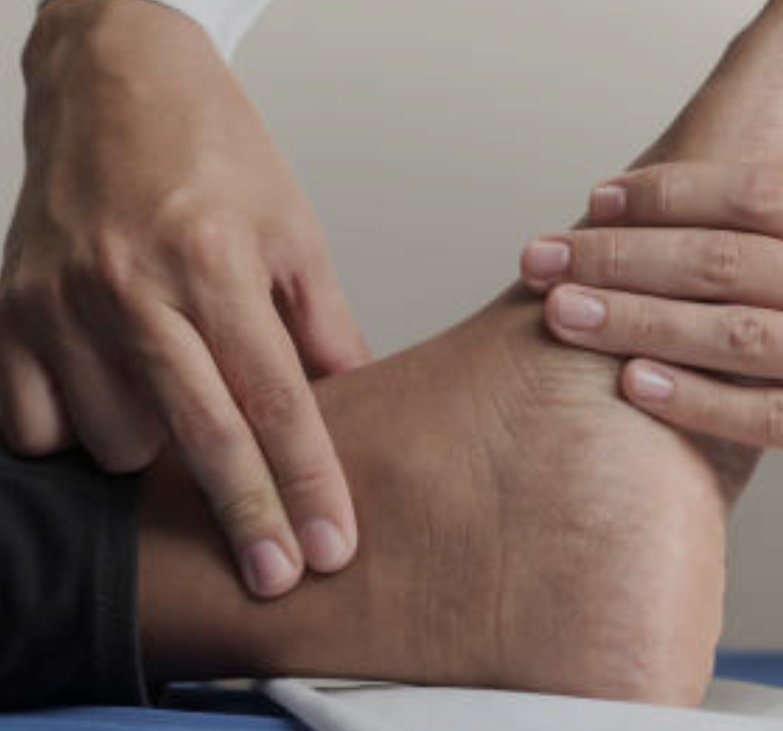 International Vascular Days, in Italia 10mila amputazioni all’anno: “Due dita sulla caviglia per evitarle”