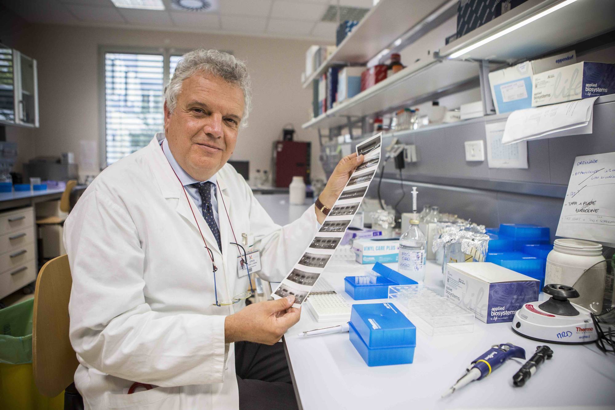 Leucemia linfoblastica acuta, studio italiano mostra l’efficacia delle cellule CARCIK