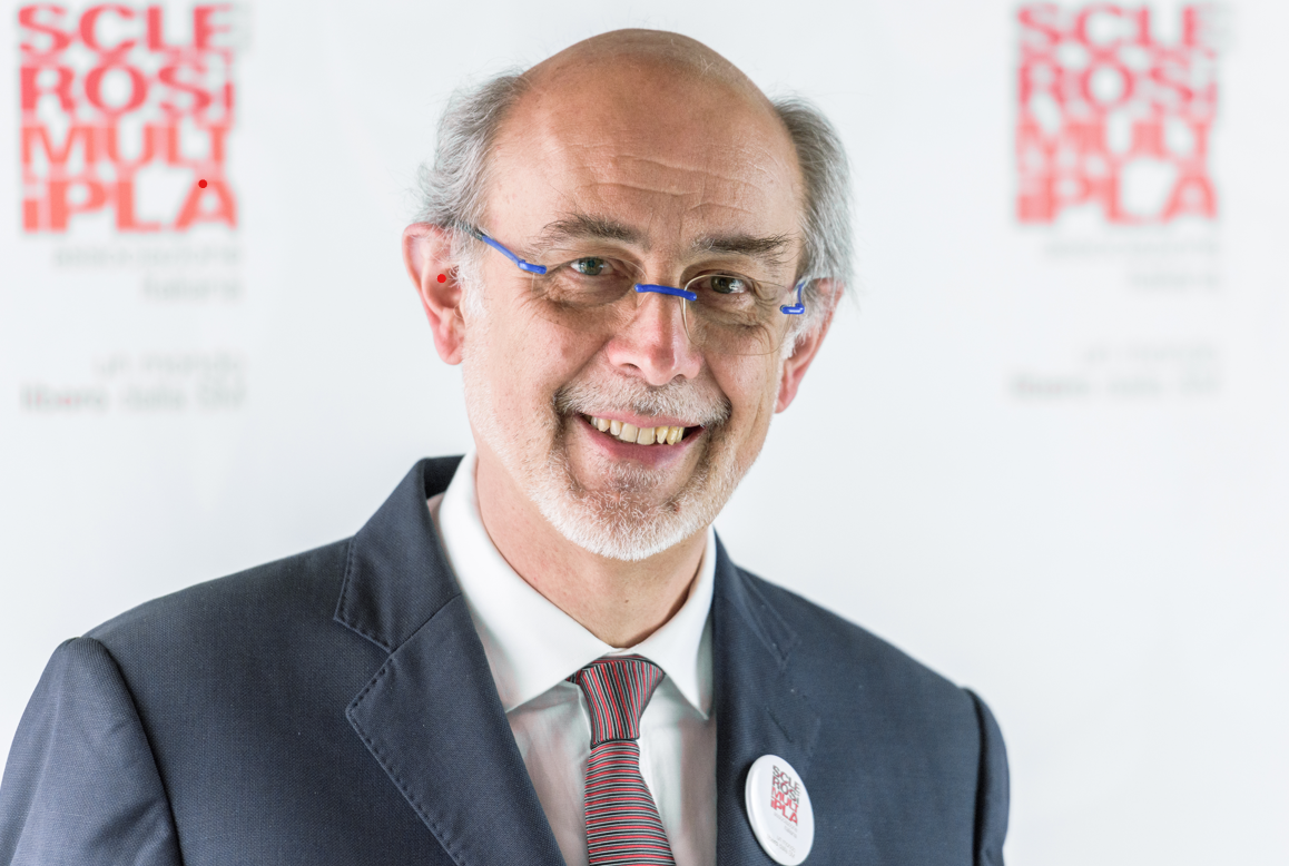 Liste d’attesa e diritto alla cura, Battaglia (Aism) : “Un problema che riguarda tutti”